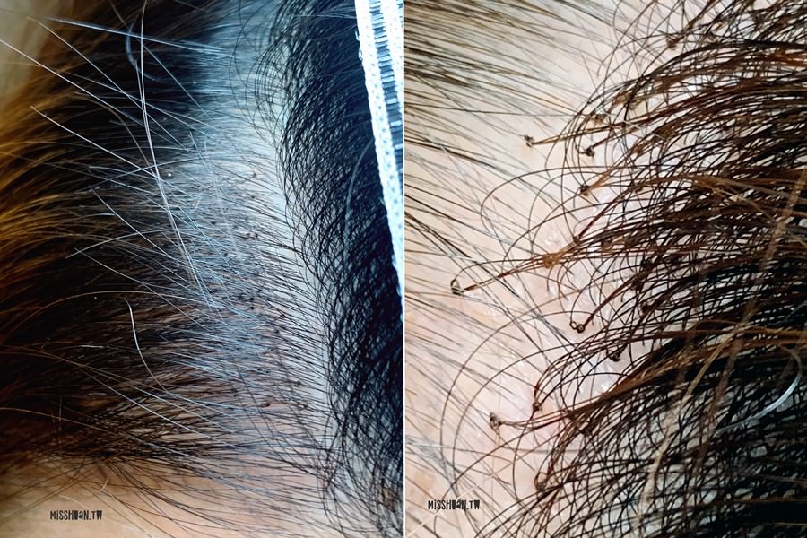 日本物理增髪中心【Mirai hairplus】增量增髮中心！專門育髮/增髮/頭皮管理．專業日本無感假髮推薦！